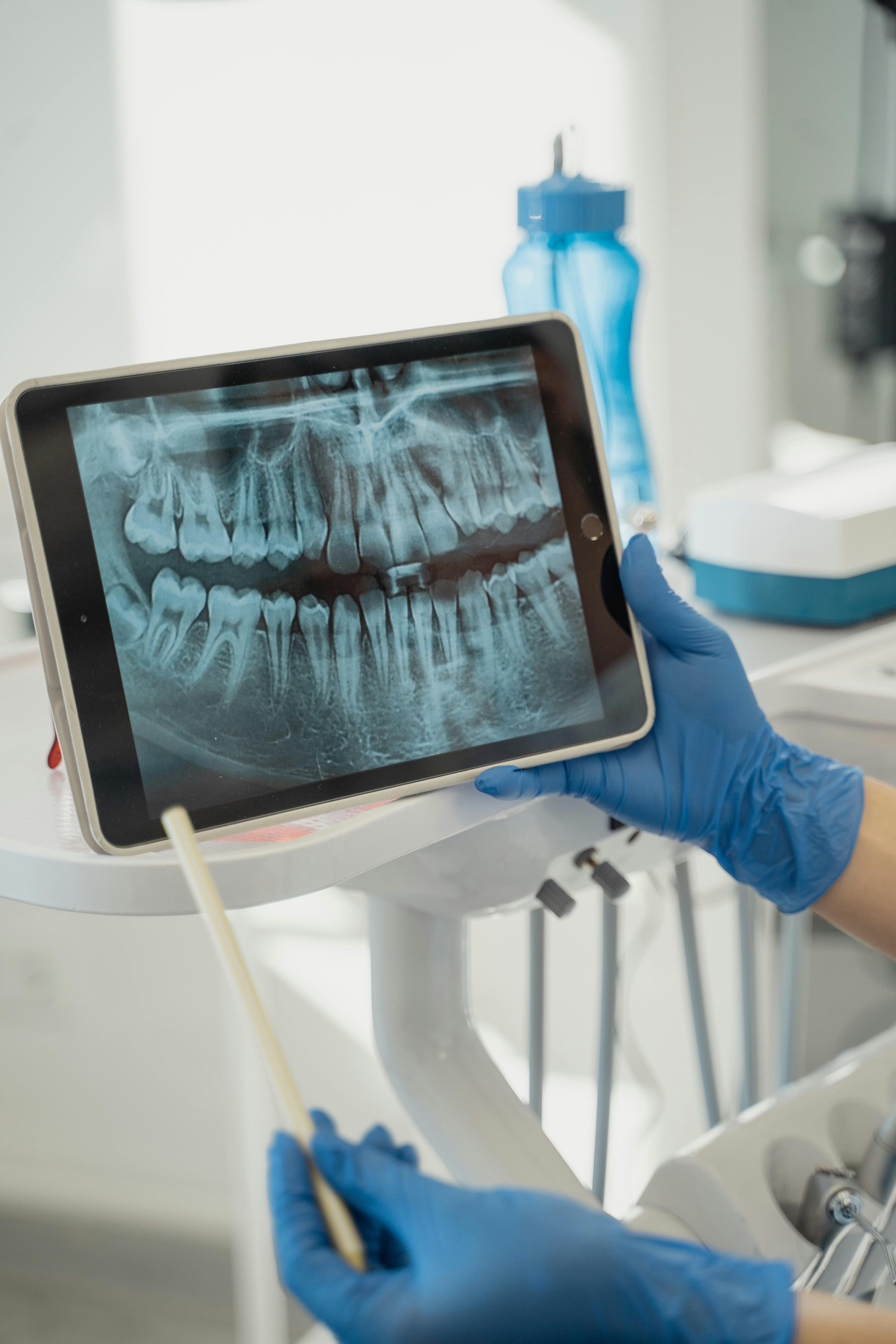 Advanced Digital X-Rays & Laser Dentistry
